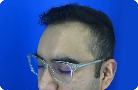 después